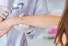 Recognising The Signs Of Skin Cancer