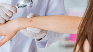 Recognising The Signs Of Skin Cancer