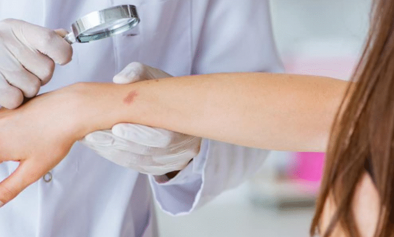 Recognising The Signs Of Skin Cancer